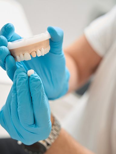 Blue-gloved hands placing a dental crown over a sample abutment tooth