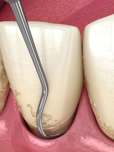 Pediatric dentist interacting with preteen boy